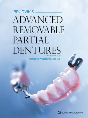 cover image of Brudvik's Advanced Removable Partial Dentures